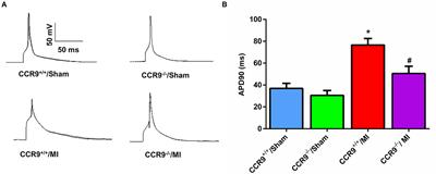 Abrogation of CC Chemokine Receptor 9 Ameliorates Ventricular Electrical Remodeling in Mice After Myocardial Infarction